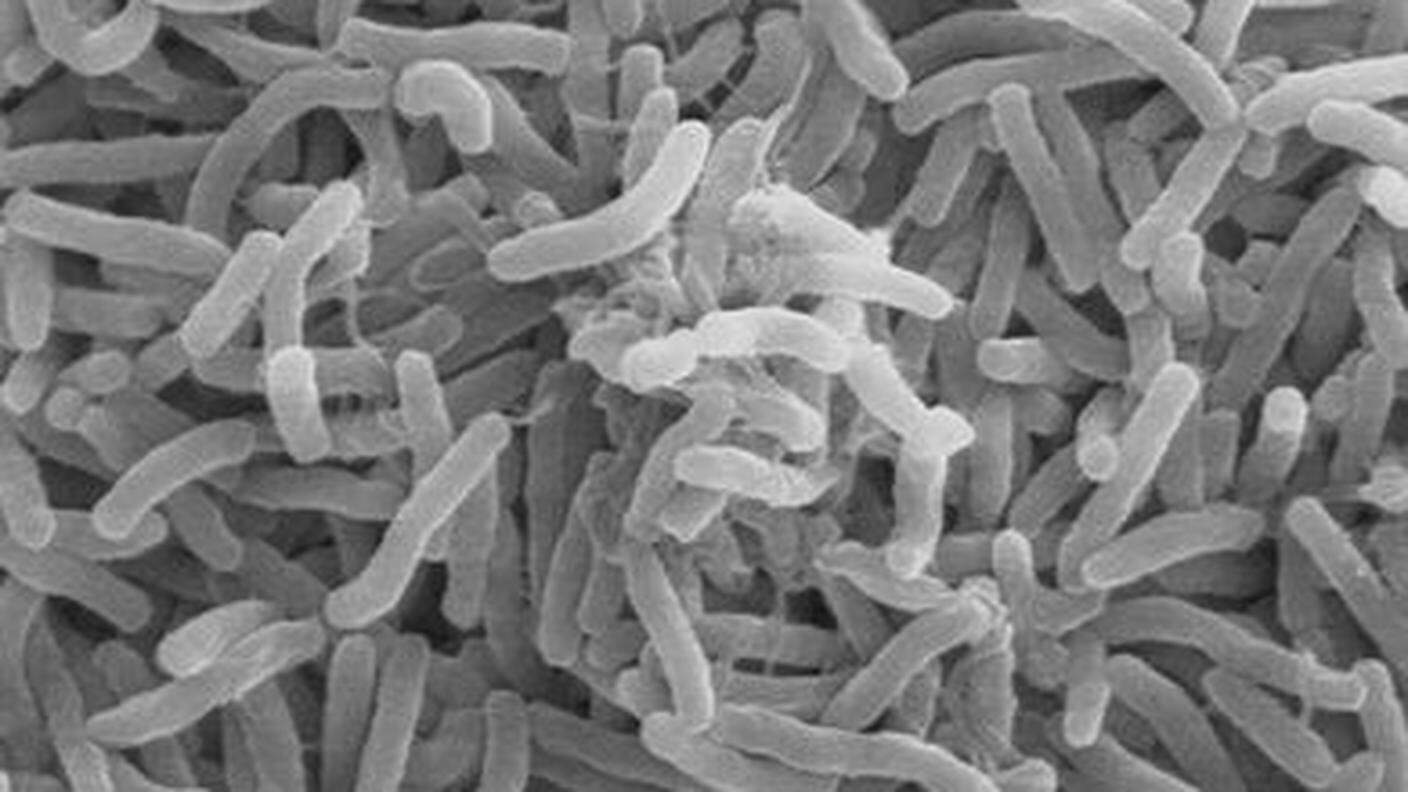 Batteri del colera al microscopio elettronico