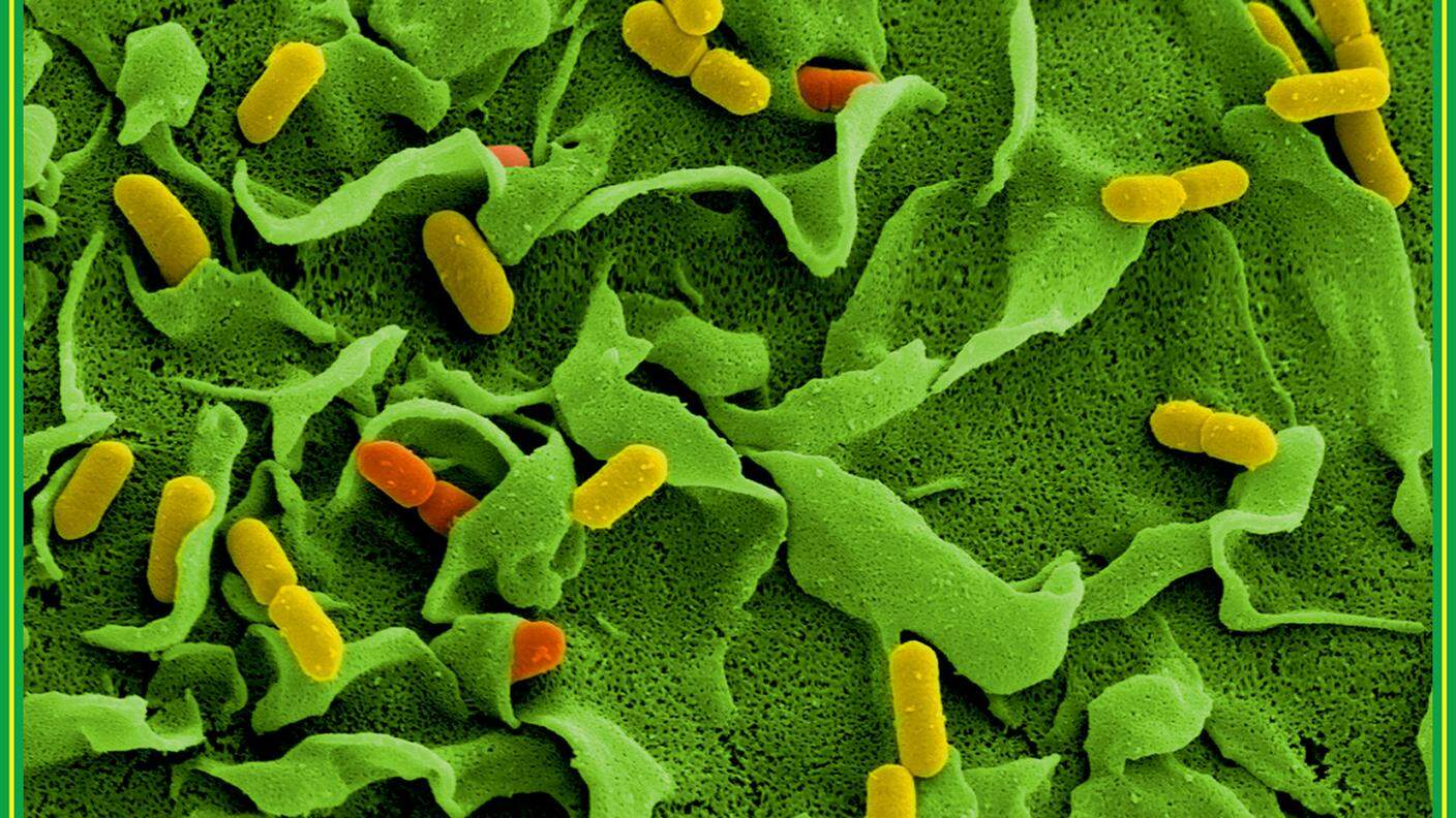 Batteri listeria visti al microscopio elettronico