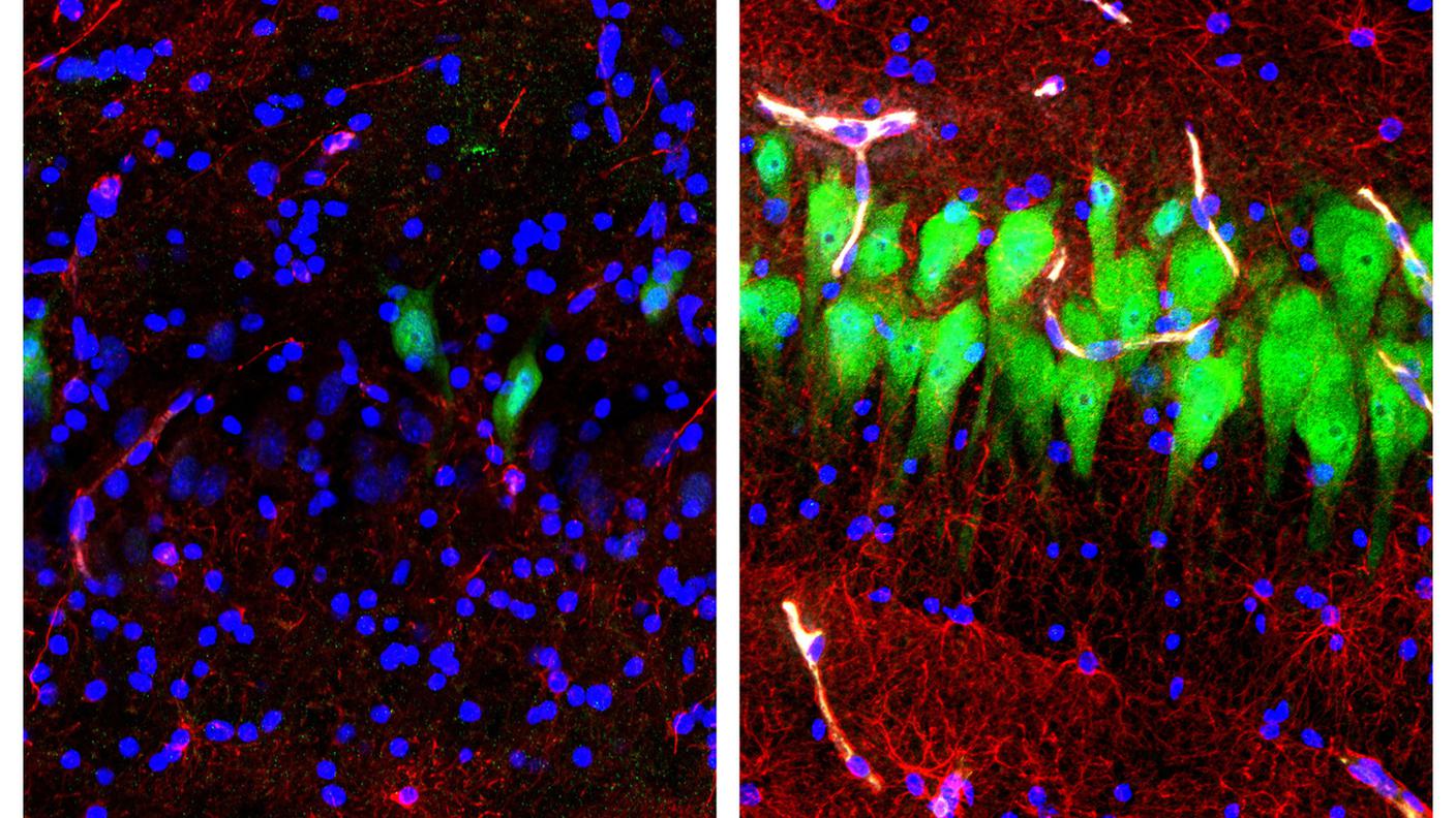L'Esperimento dell'università di Yale sul cervello di maiale non trattato per 10 ore dopo la morte