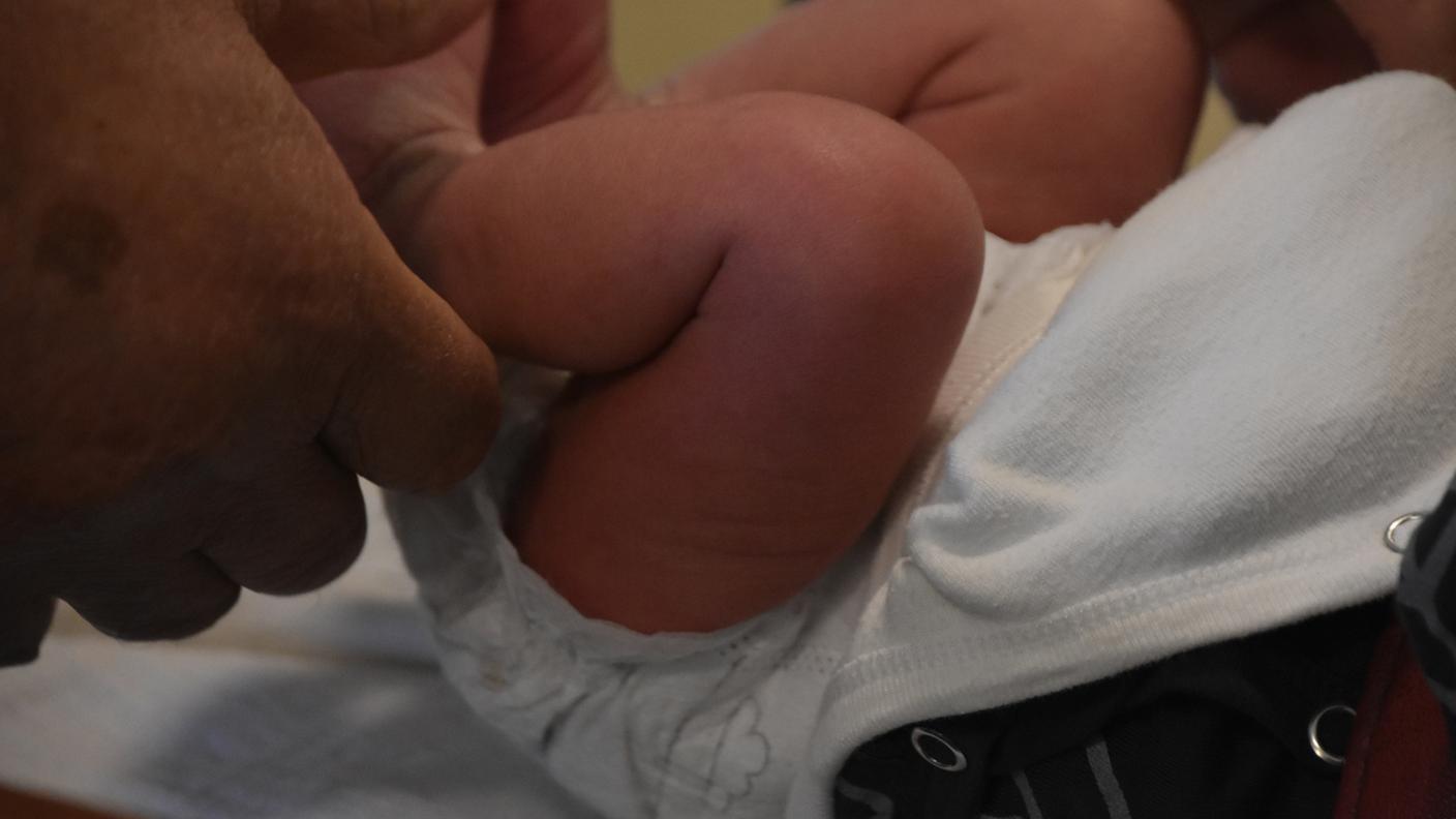 iStock-Bambino, circoncisione 