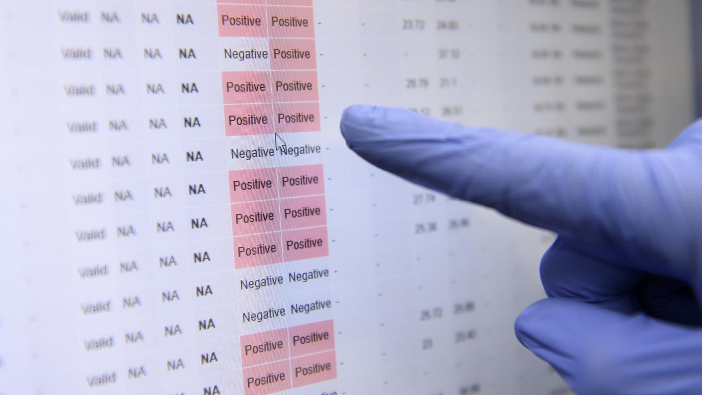 Positivo quasi il 40% dei test