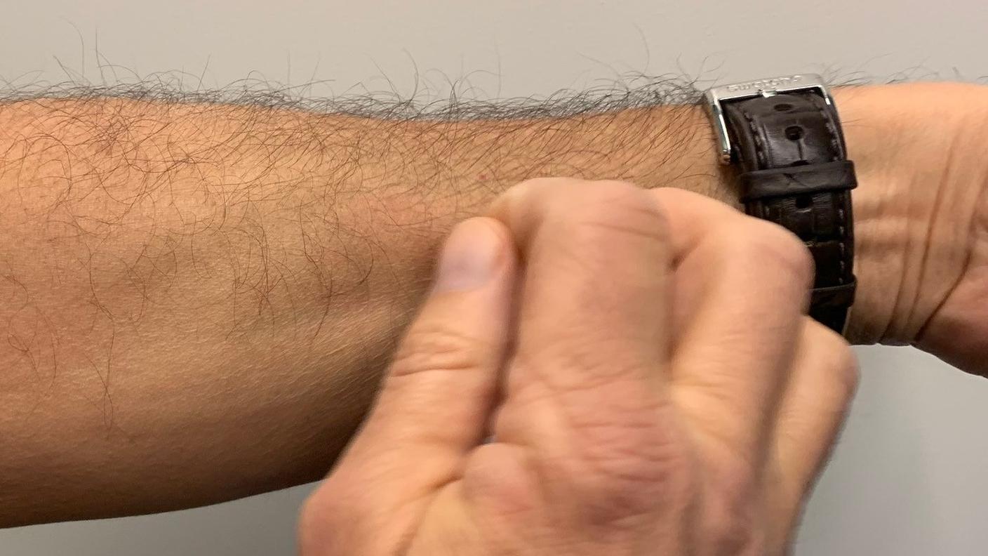 I casi di orticaria, dopo il booster, sono più frequenti