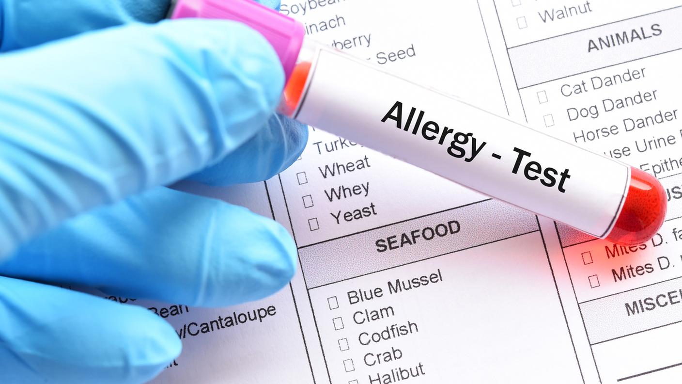 test sulle allergie