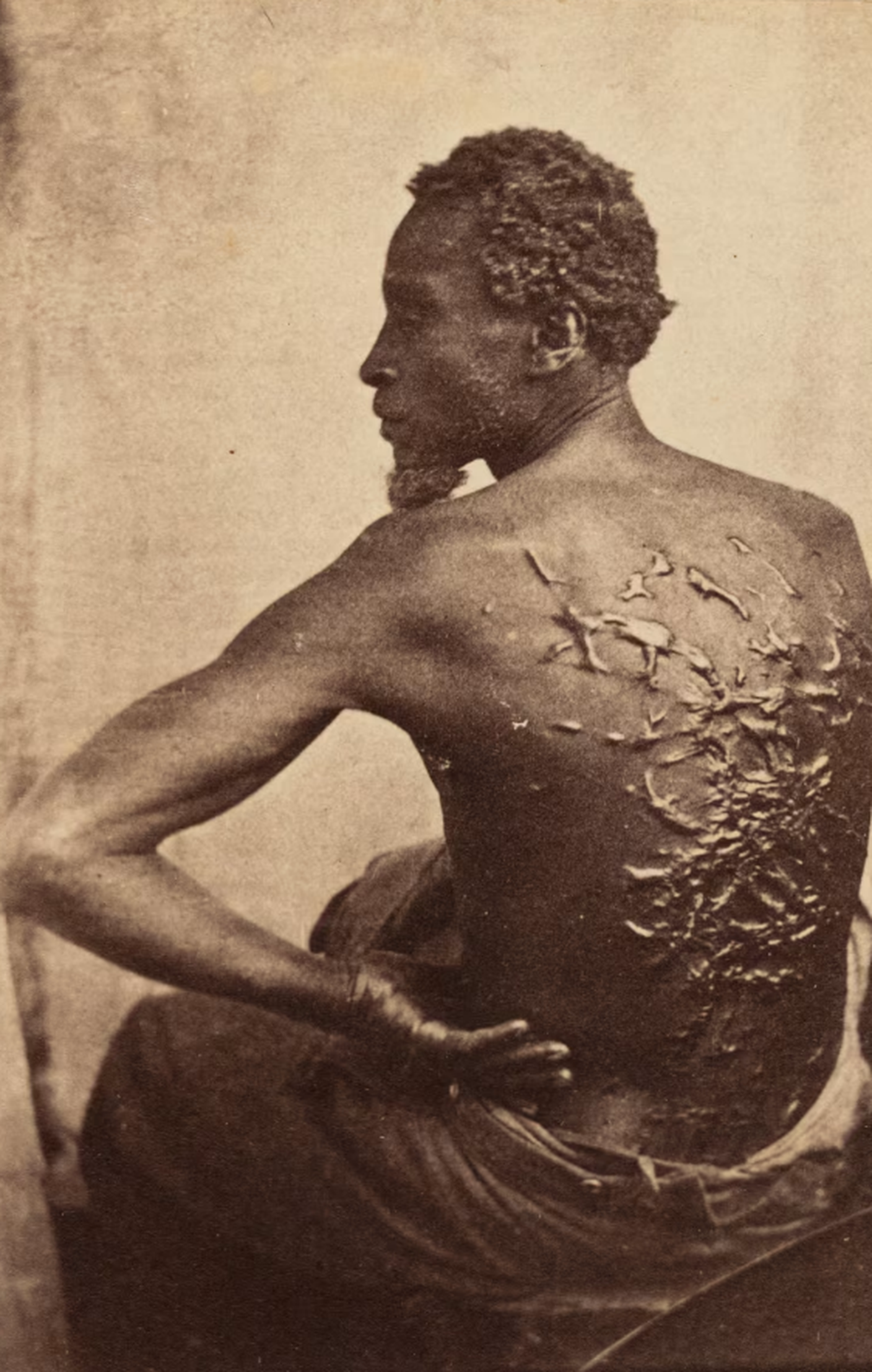 Scourged Back 