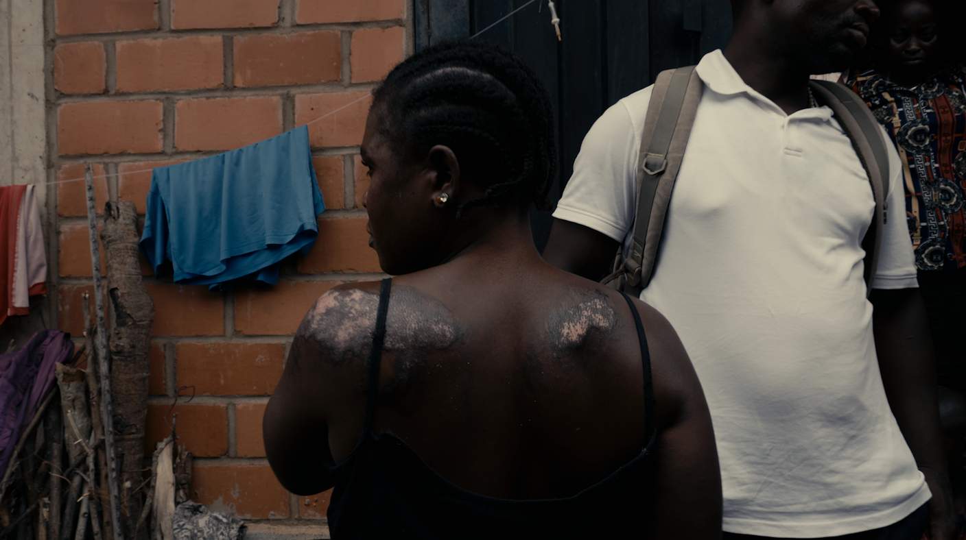 Yelwata, Benue:  una donna sopravvisuta ad attacco fulano che ora vive nel capo per sfollati interni di Makurdi