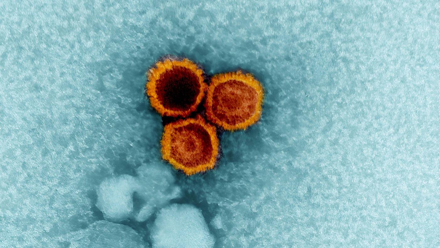 Un'immagine al microscopio di tre virus Epstein-Barr, tra i fattori ambientali alle origini della sclerosi multipla 