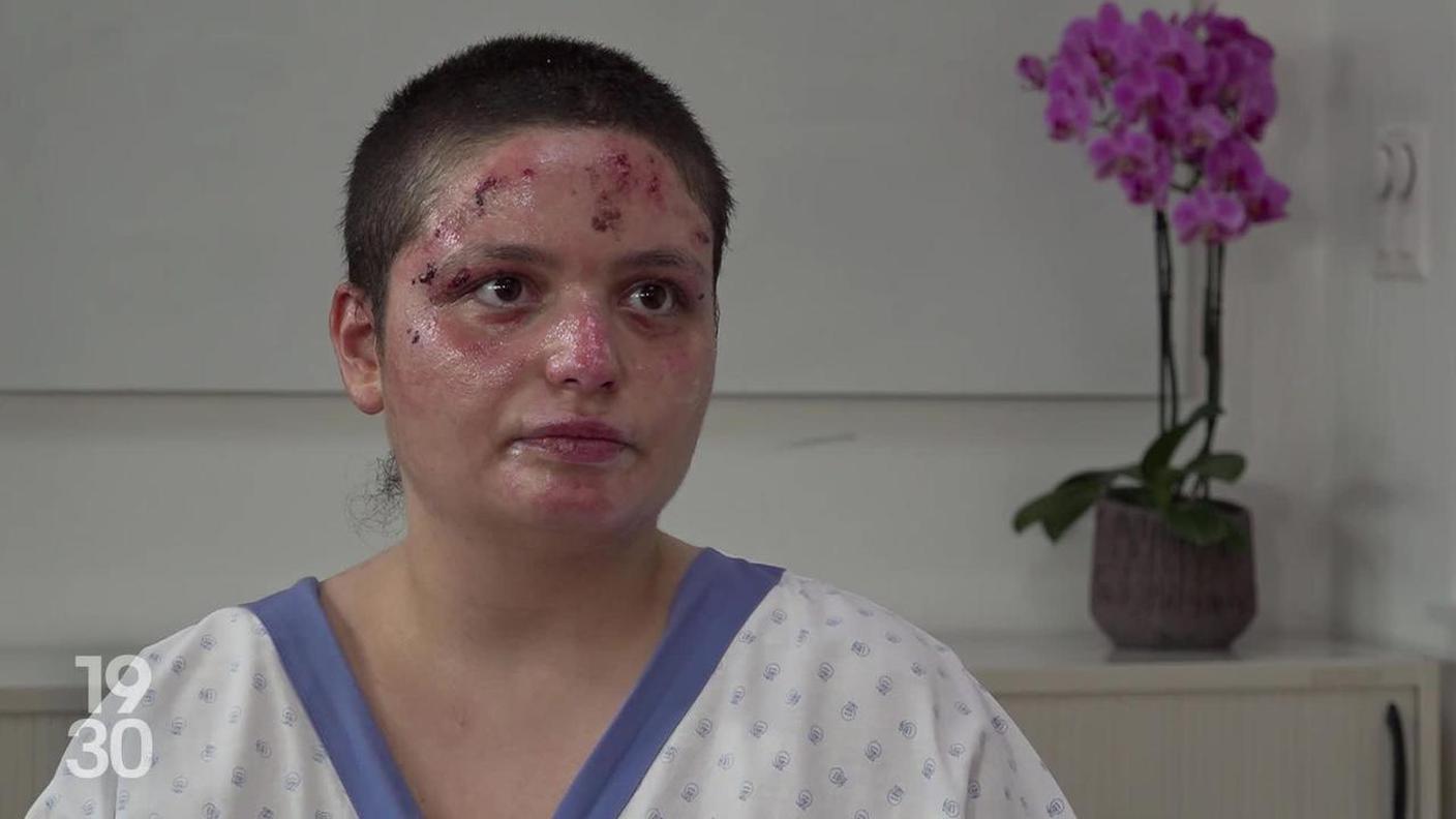 Roze, sopravvissuta all'incendio di Crans-Montana