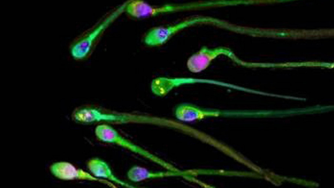 Gli spermatozoi umani potranno in futuro essere aiutati nel loro tragitto verso l'ovulo
