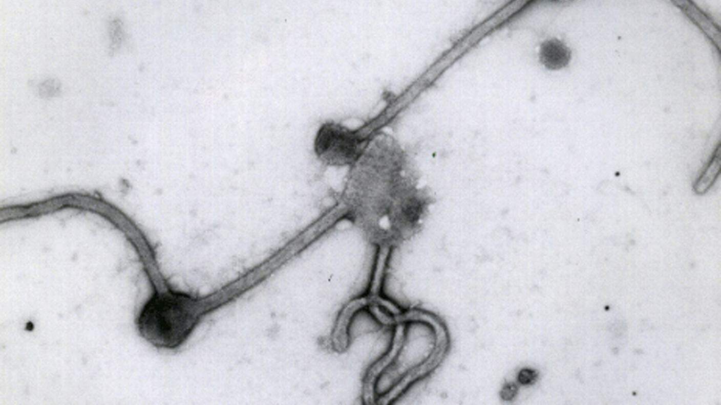 Il virus dell'ebola al microscopio elettronico 