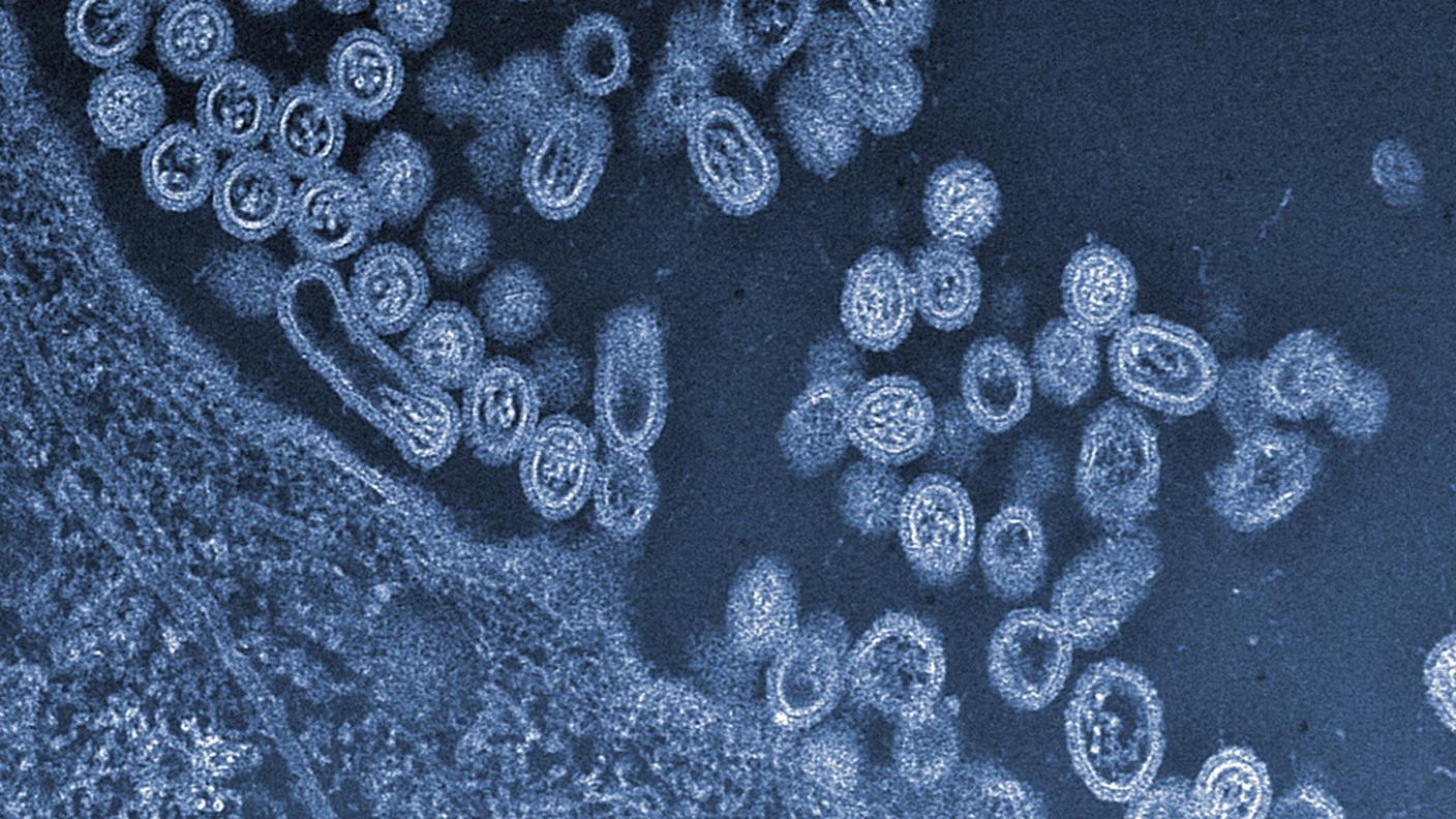 Il virus dell'influenza aviaria H7N9