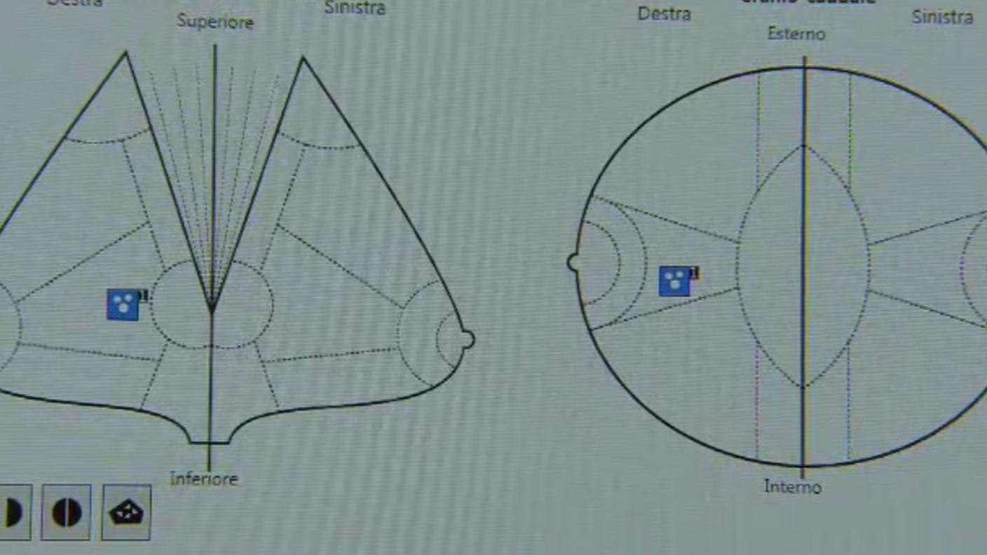 screening mammografico.JPG