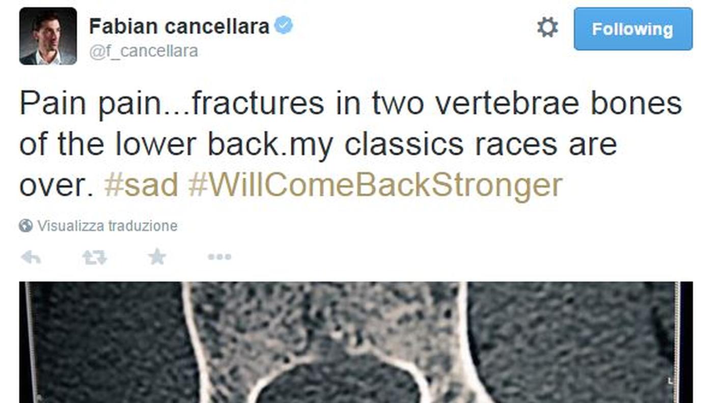 Cancellara twitta la sua radiografia