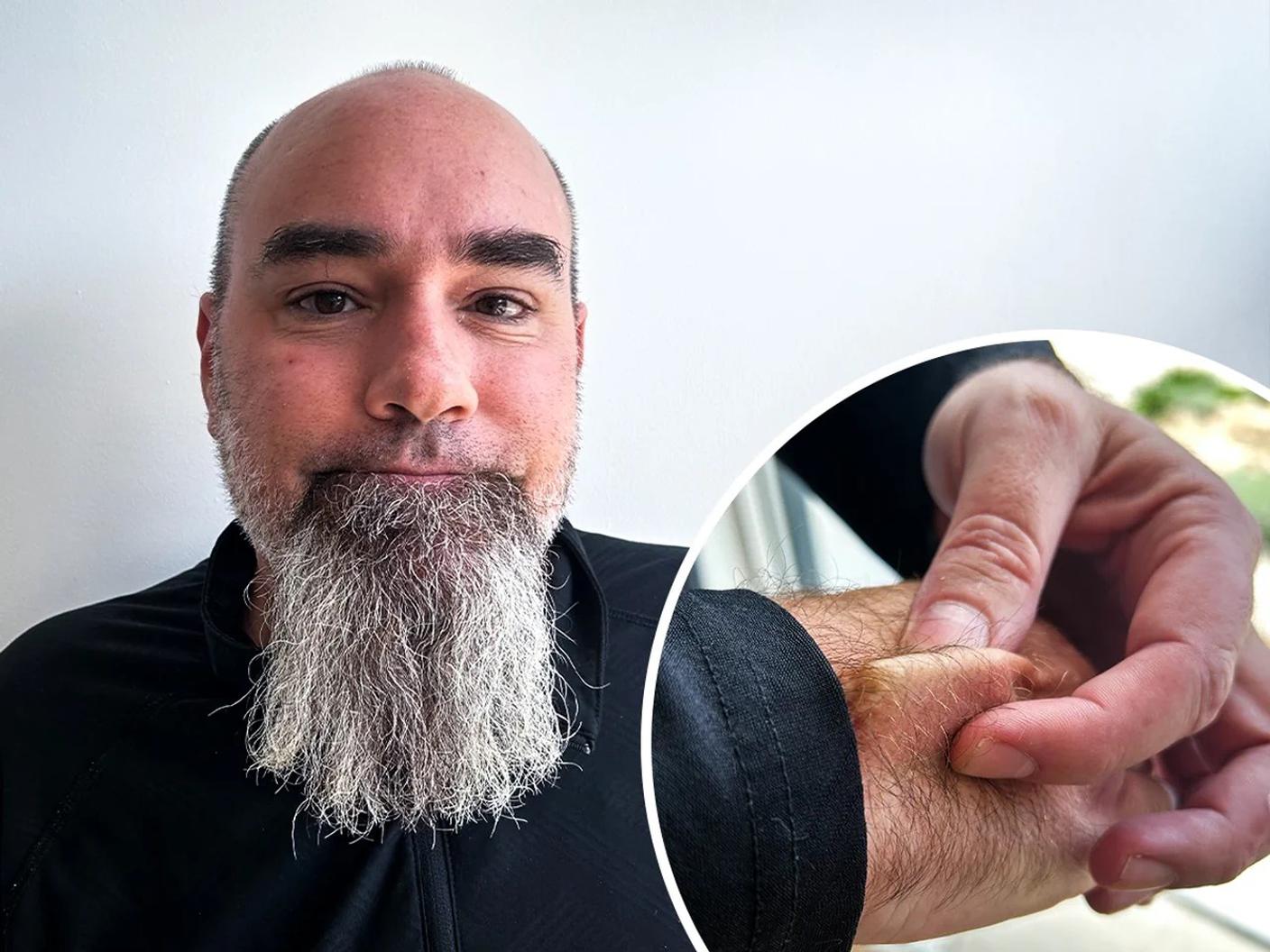 Rich Lee mostra il chip impiantato nella sua mano