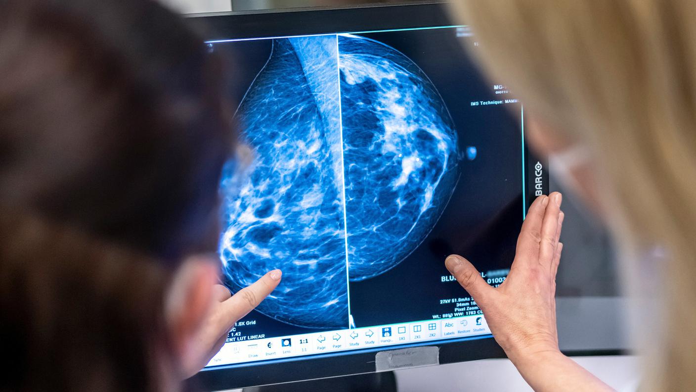 Il tumore al seno triplo negativo è particolarmente difficile da curare