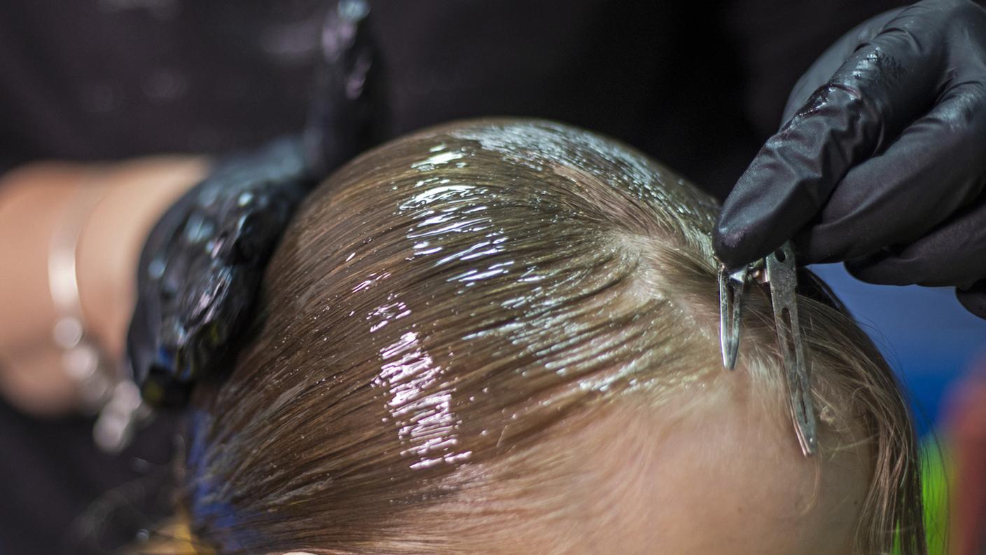 Capelli tirati e una generosa dose di gel o lacca nel tempo possono portare alla perdita di capelli sulle tempie