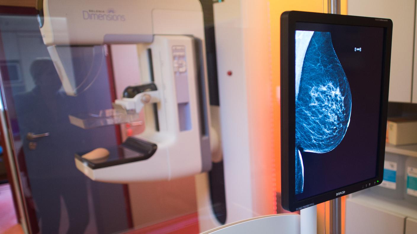 Il cancro al seno rappresenta circa un terzo di tutti i casi di cancro diagnosticati nelle donne in Svizzera