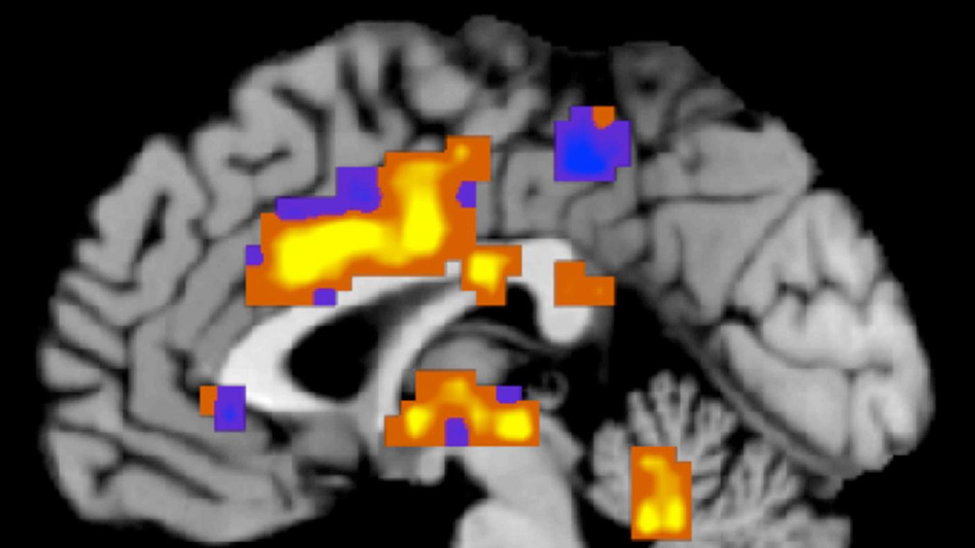 Un programma di 7 anni per migliorare lo stato del cervello