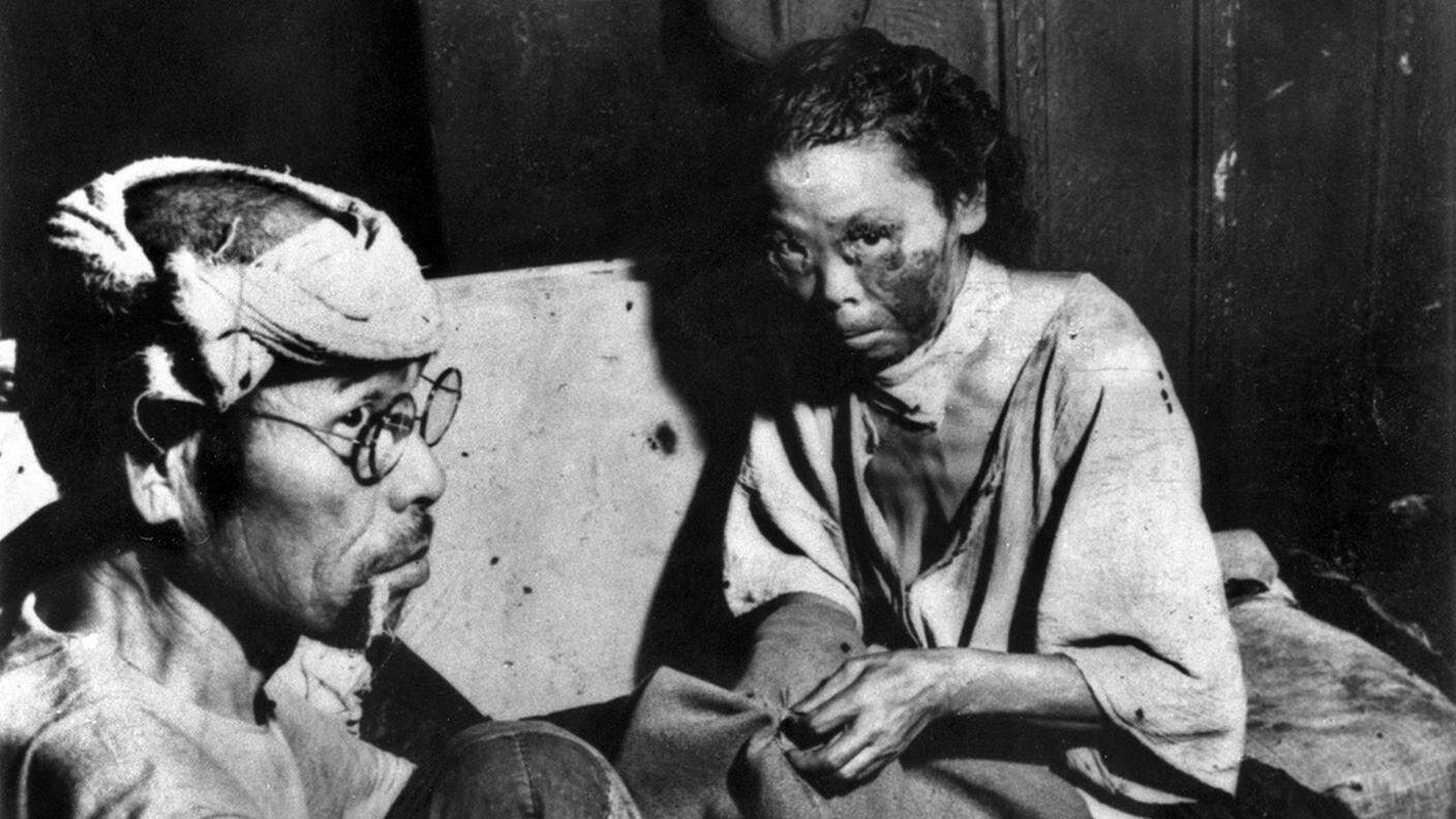 Hiroshima, vittime di "Little Boy"