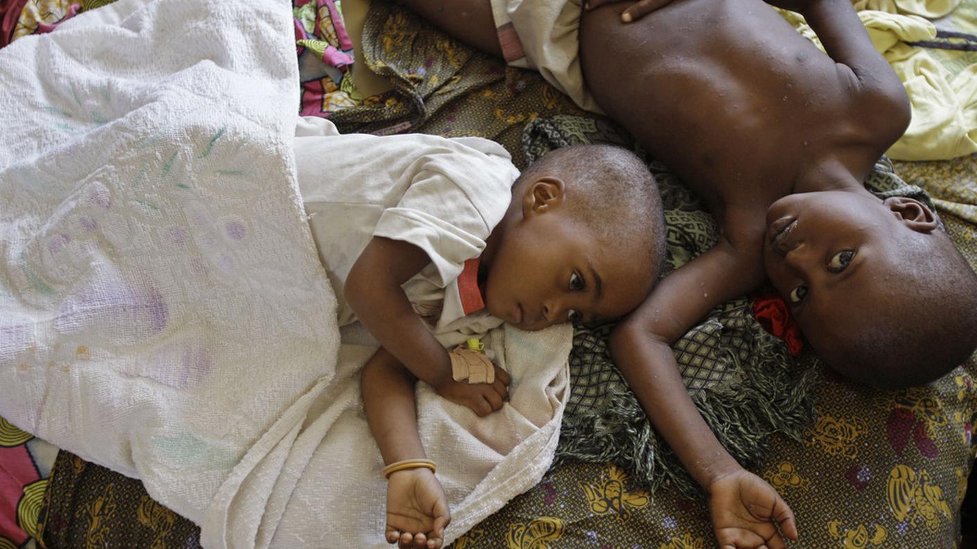Due bambini colpiti dalla malaria