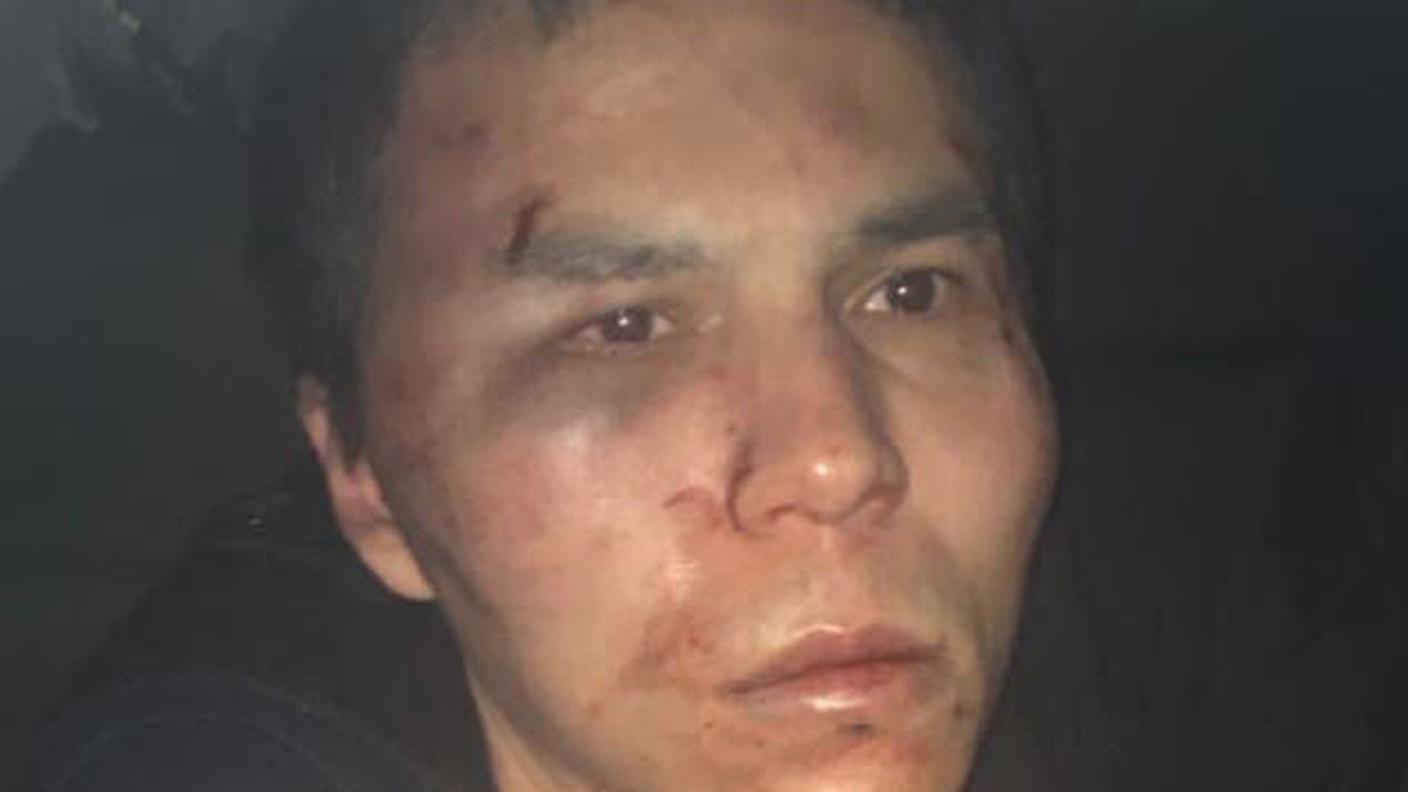Il volto dell'uomo dopo l'arresto