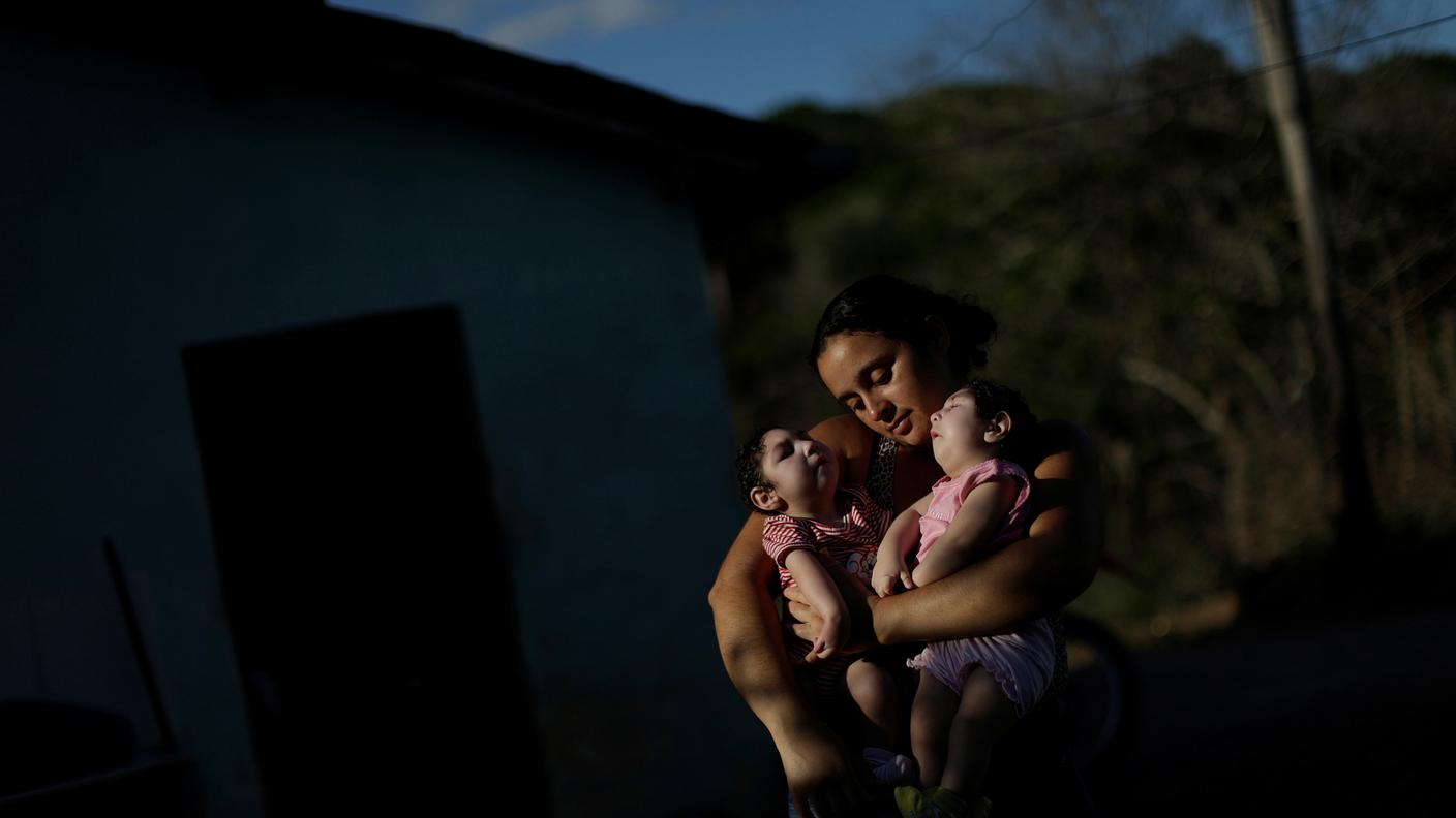 Una mamma stringe le sue gemelline di 10 mesi entrambe affetta da microcefalia