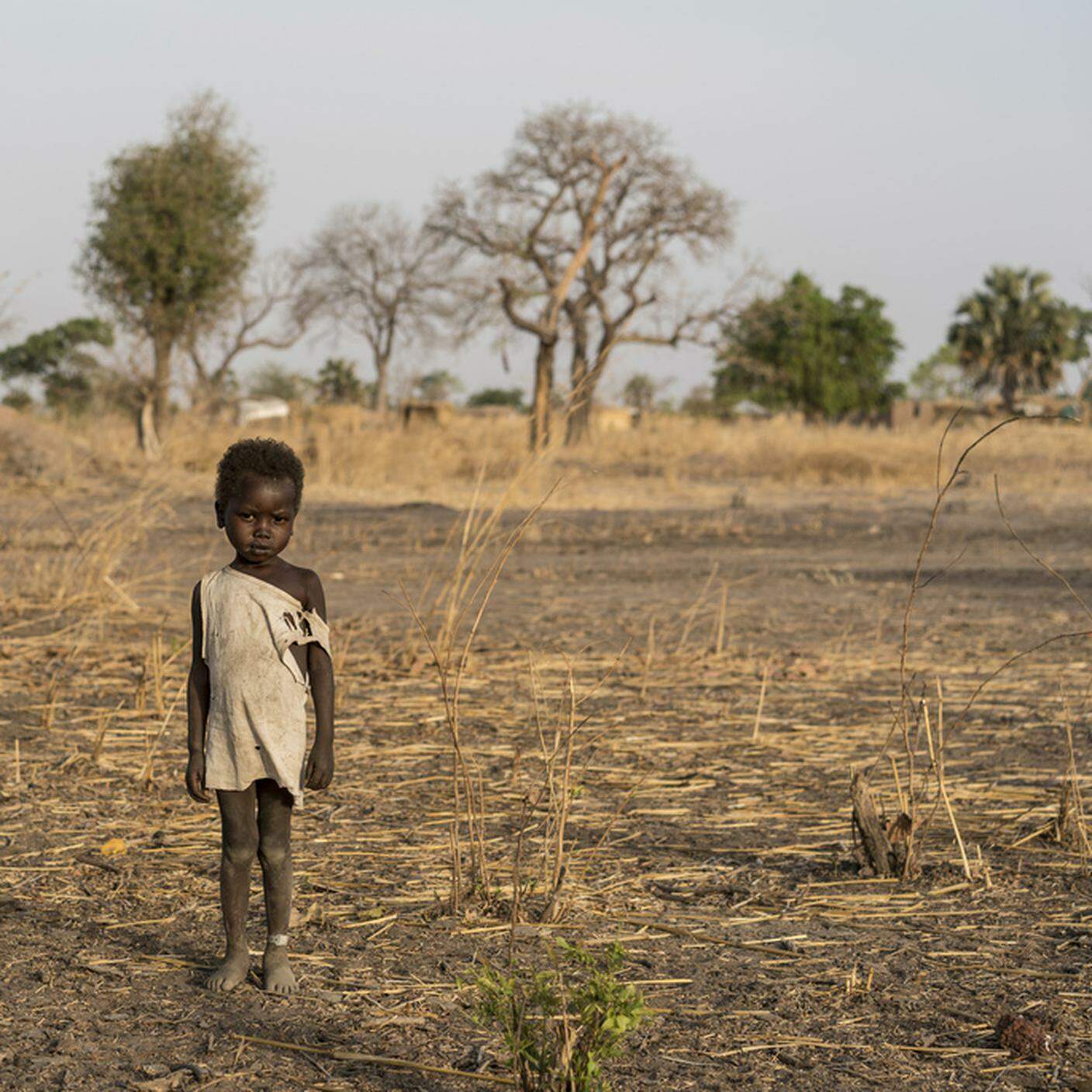 Emergenza carestia in Africa
