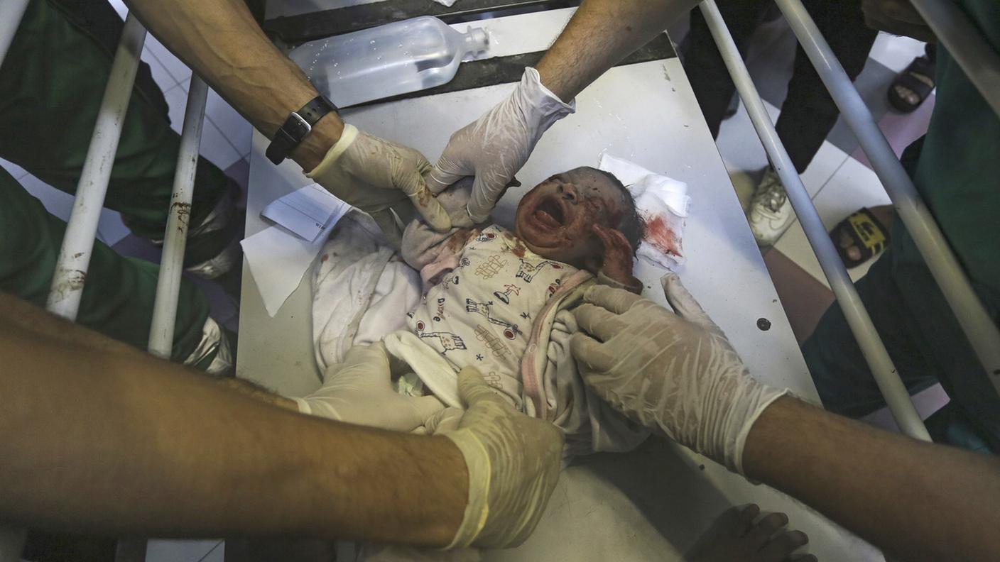 Un neonato ferito curato all'ospedale al-Shifa di Gaza
