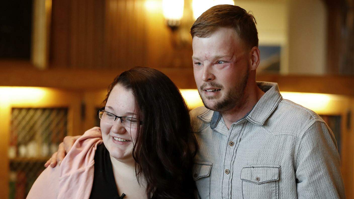 Lilly Ross e Andy Sandness si sono visti 16 mesi dopo l'operazione
