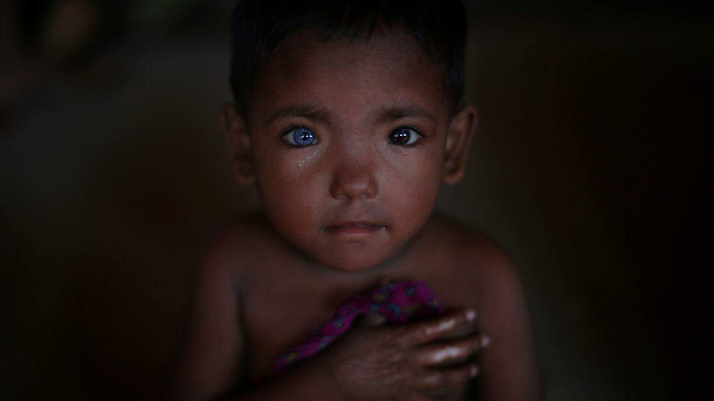 Hosne Ara, di 4 anni, fotografato al campo profughi di Kutupalong nel bangladesh