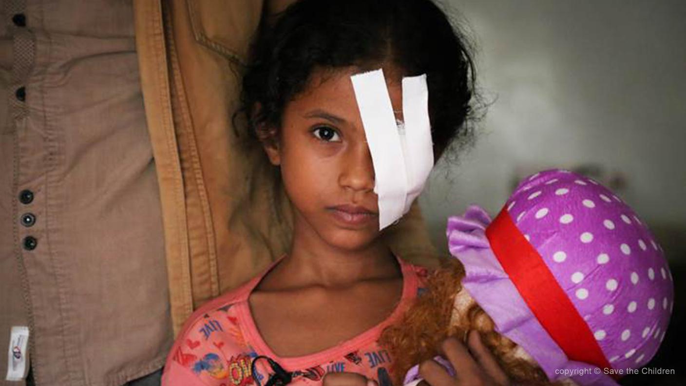 I primi ad avere bisogno di aiuto sono i bambini quasi 2 milioni sono in pericolo a causa della malnutrizione.jpg