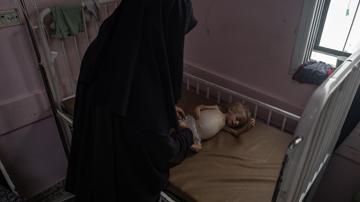 Un bambino di due anni fortemente denutrito fotografato con la madre in un ospedale di Gaza il 10 agosto