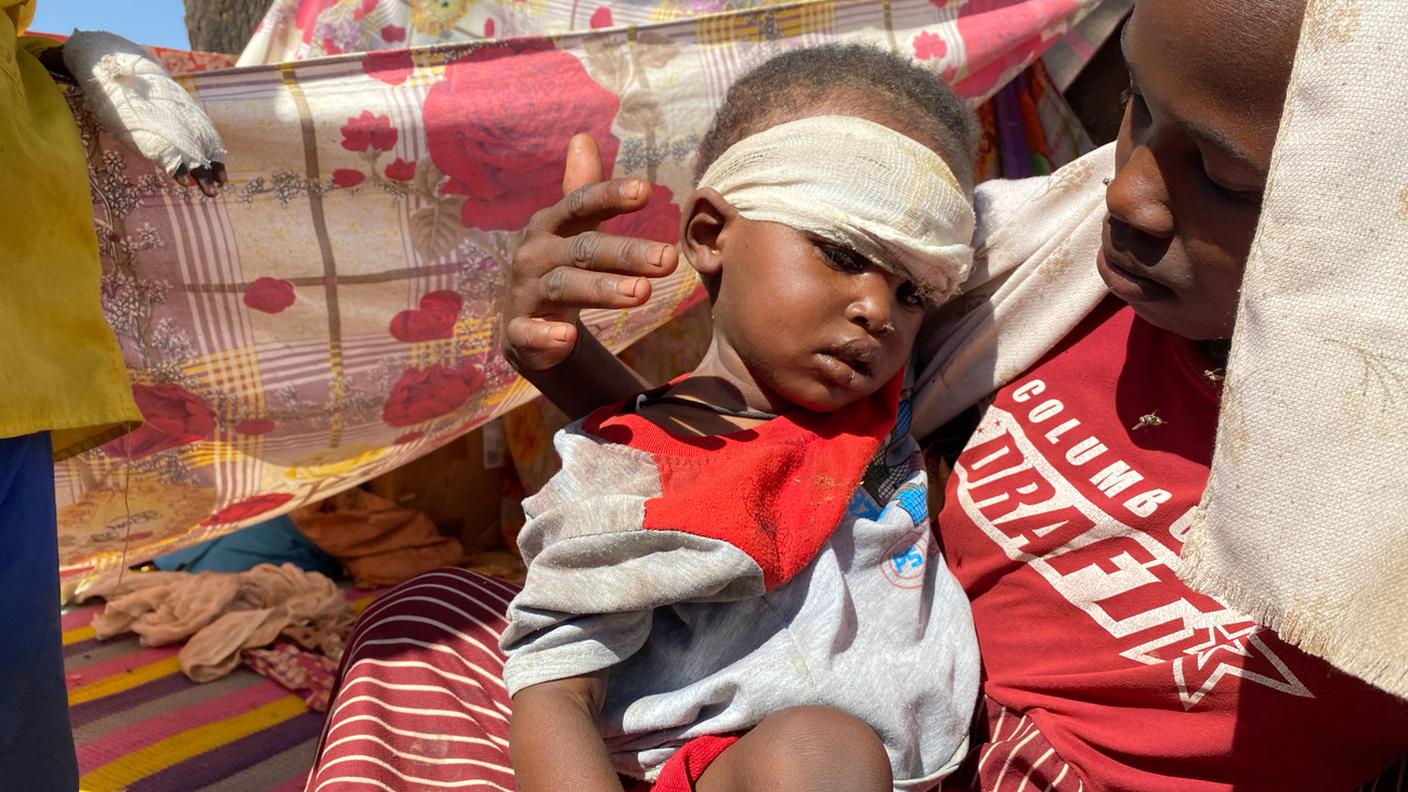 Un bambino sudanese fuggito da un attacco delle RSF lo scorso novembre riceve cure in un campo profughi a Tawila