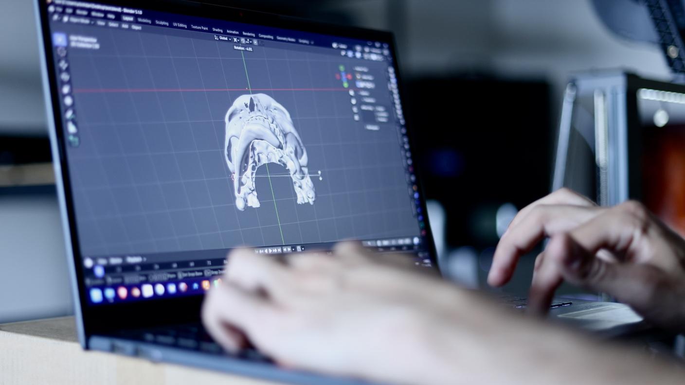 La modellizzazione 3D è fondamentale anche per aiutare i chirurghi nelle ricostruzioni facciali