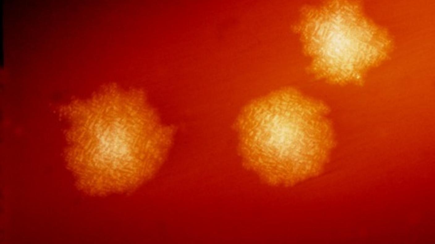 In particolare le "donazioni" serviranno contrastare l'infezione da clostridium difficile