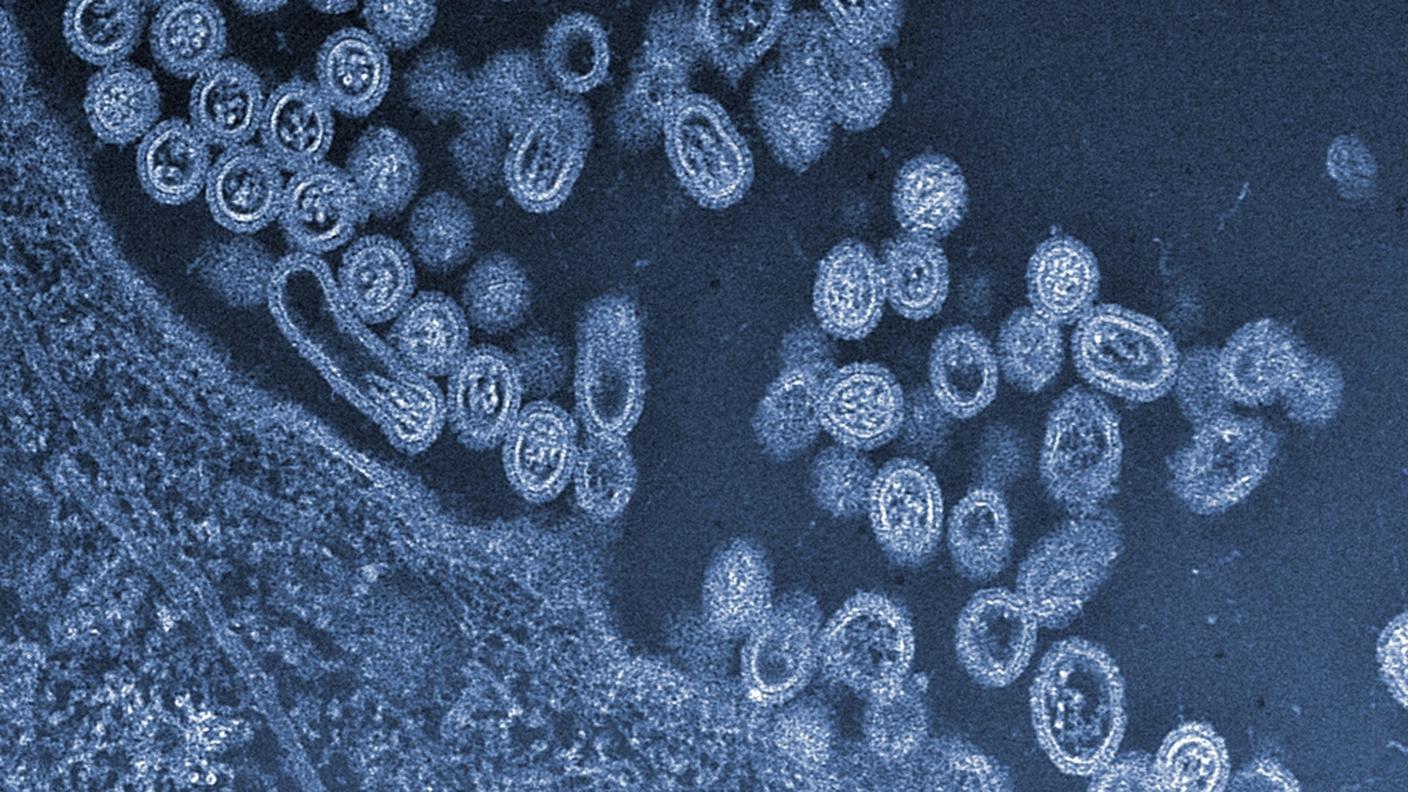 Ceppo H7N9 del virus dell'influenza aviaria