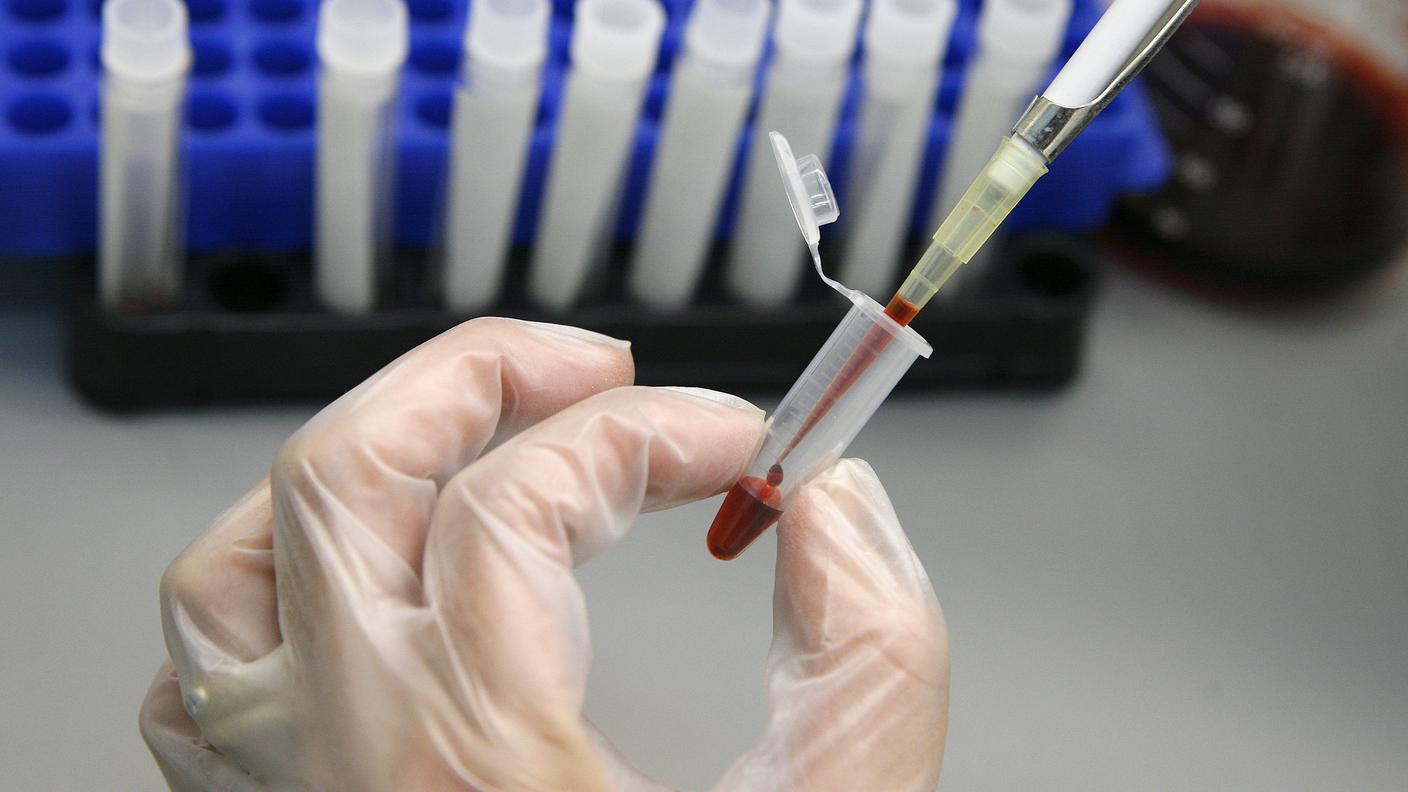 Un test per l'HIV