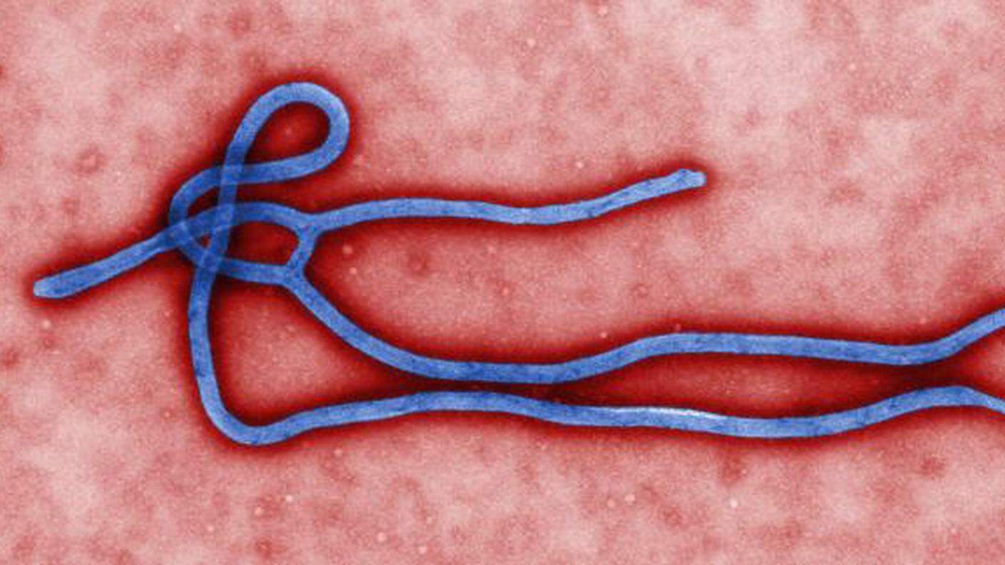 Il virus dell'ebola al microscopio