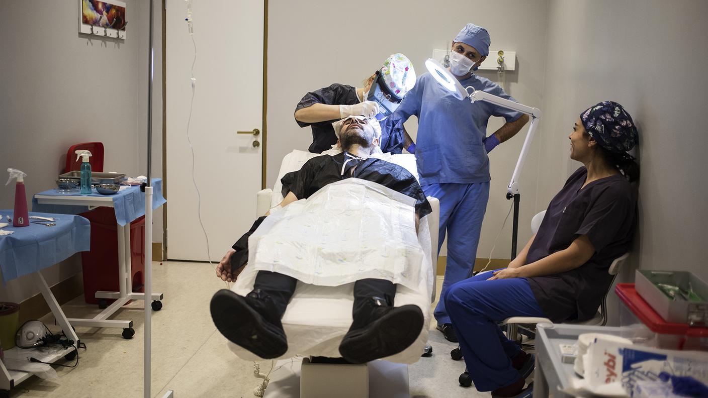 Il trapianto di capelli consiste nella estrazione dei bulbi sani che vengono impiantati nelle zone dove i capelli non crescono più