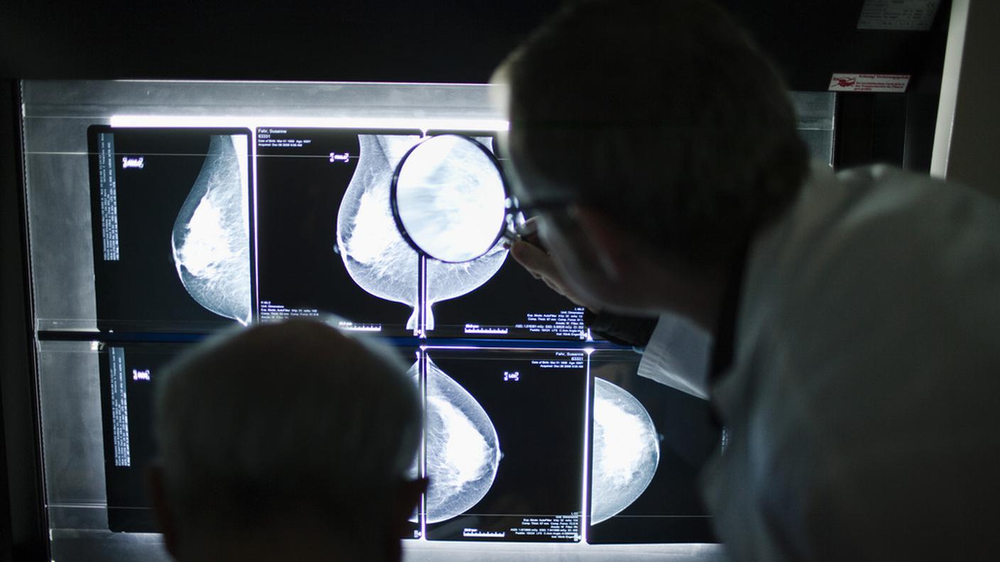 L'esame di una lastra dopo una mammografia