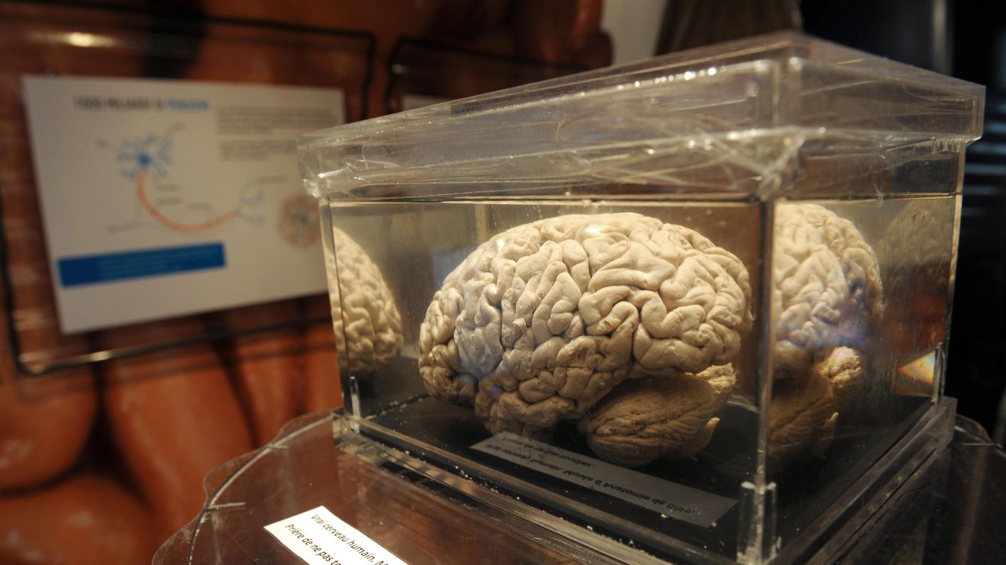 Non esiste un vero e proprio diformismo sessuale del cervello