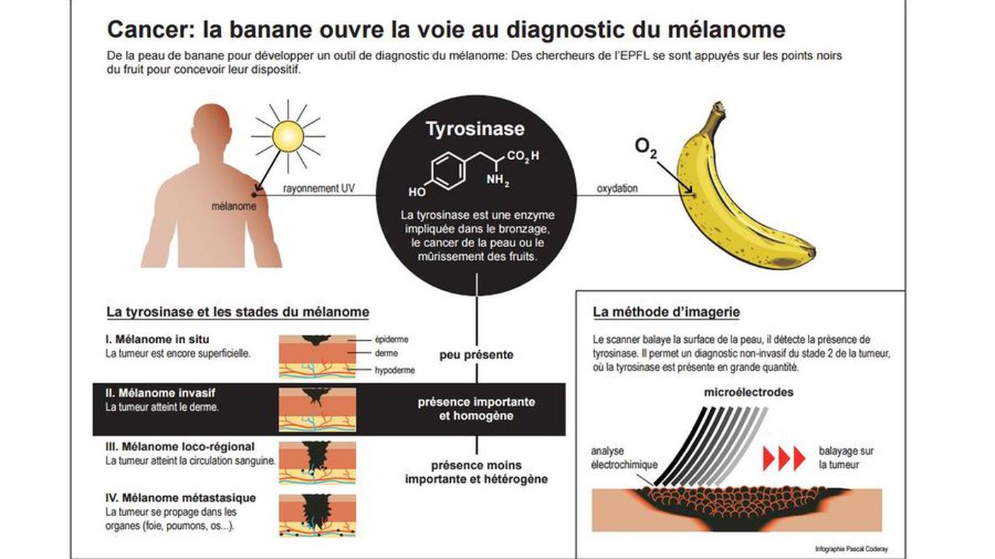 Un nuovo tipo di diagnosi