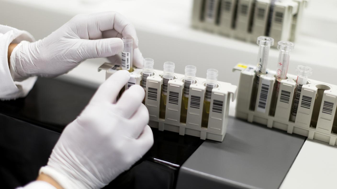 Trentacinque anni fa diagnosticati i primi casi della malattia