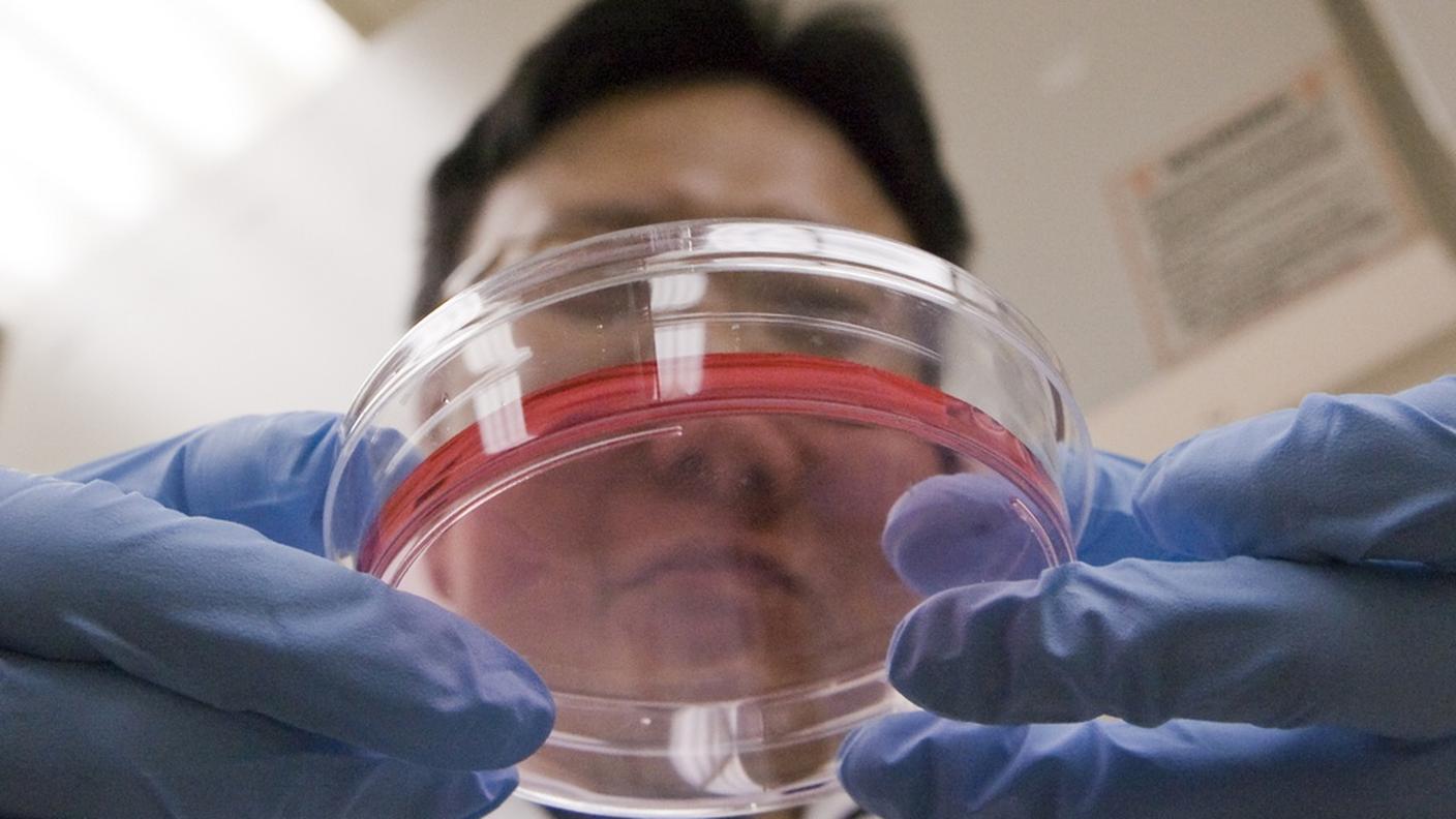 Ha dimensioni che in vitro vanno da uno a due millimetri