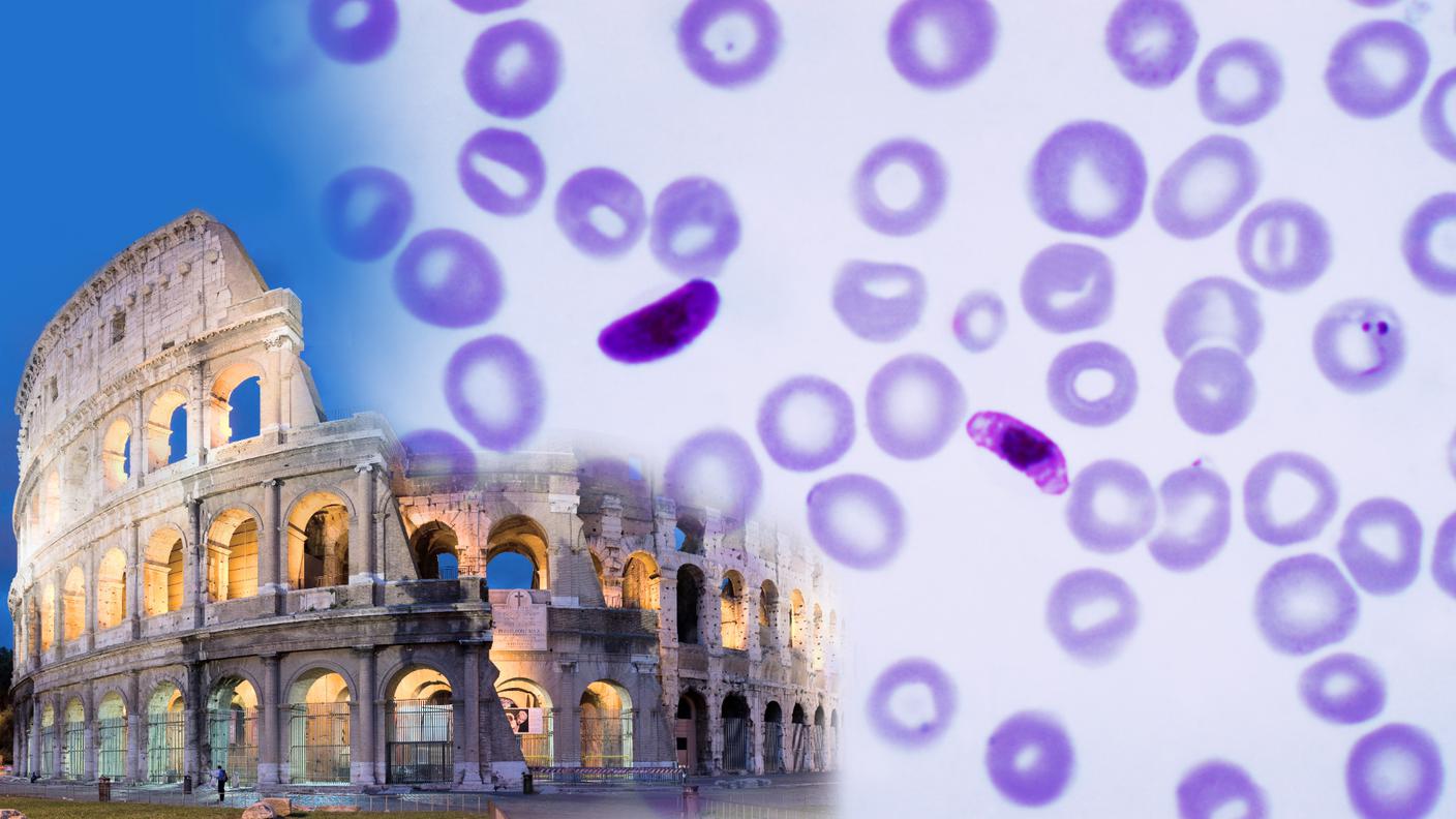 Il colosseo e, a destra, sangue con Plasmodium falciparum