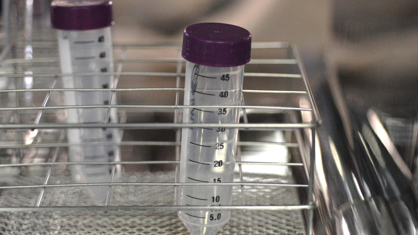 Le cellule staminali preposte alla produzione di sperma si possono riattivare anche dopo 20 ani di conservazione