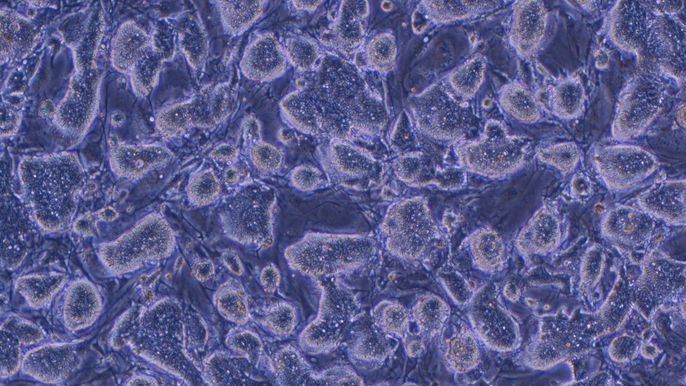 Le cellule adipose in aiuto del corpo umano