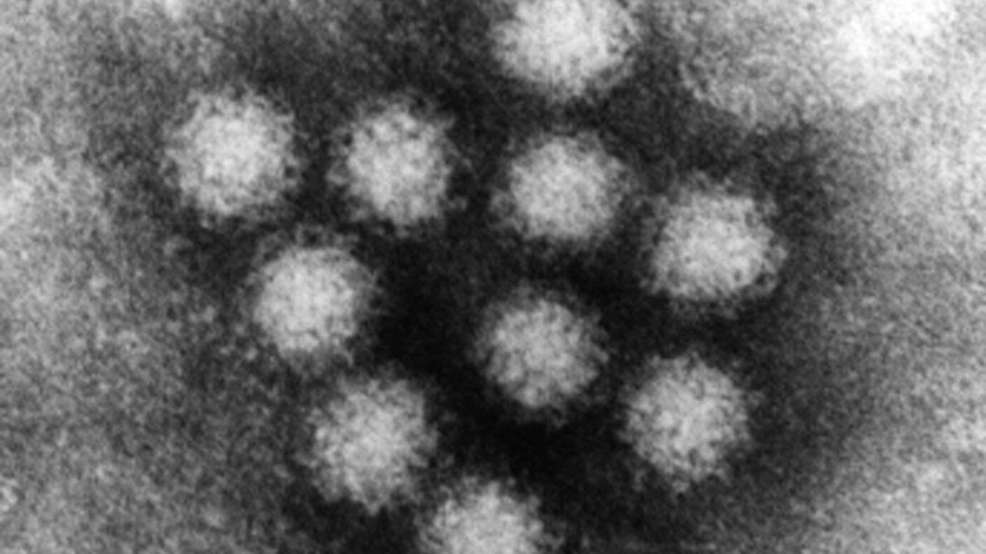Il virus, molto contagioso, si diffonde rapidamente con caldo e umidità