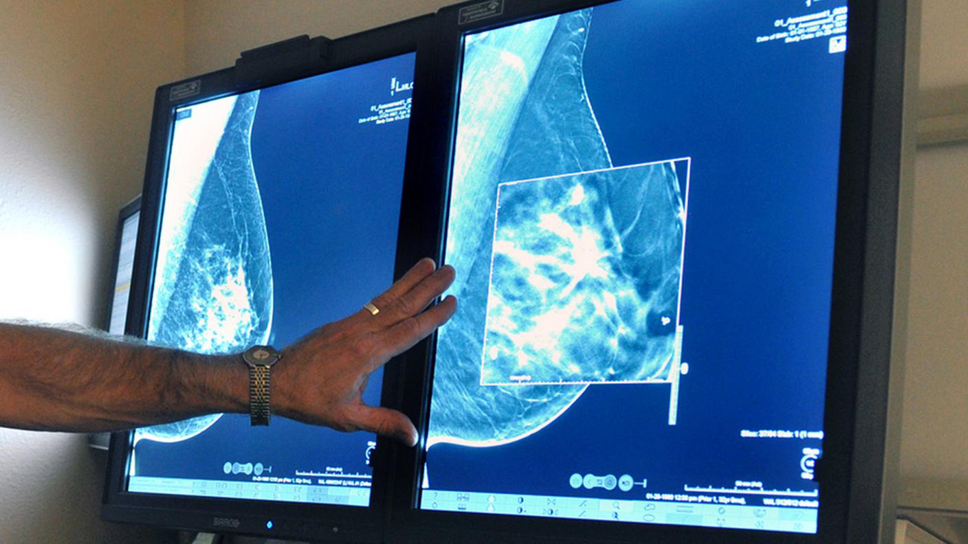 Dati sui tumori in un unico registro nazionale
