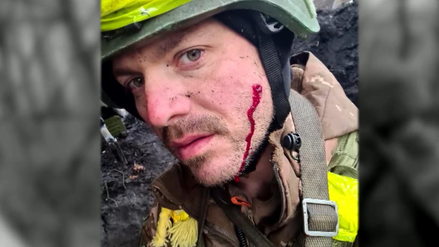 Jérôme dopo l'esplosione