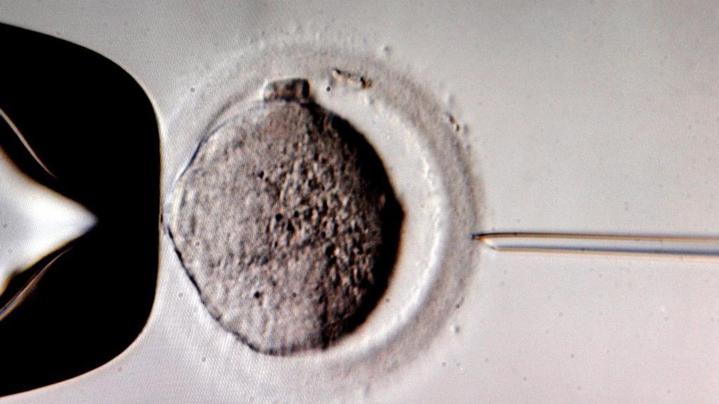 fecondazione in vitro procreazione assistita ky.JPG